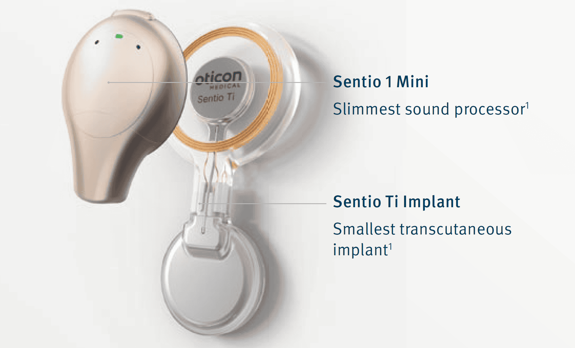 Sentio Incision Sentio un nouvel implant auditif à ancrage osseux
