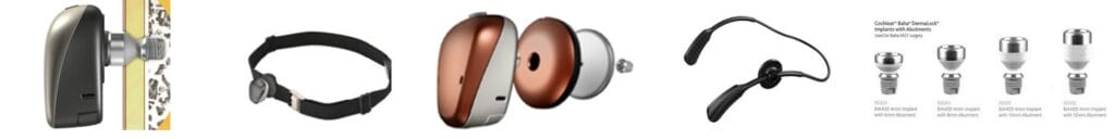 Les différents types de support pour les appareils auditifs à conduction osseuse Cochlear Baha